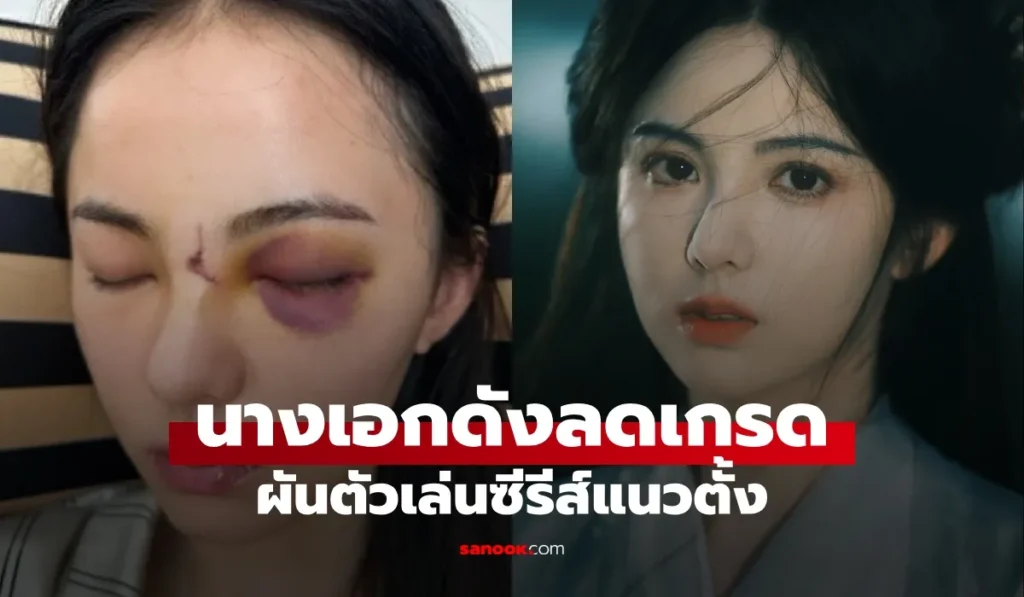 หวงรื่ออิ๋ง รับบทนำในซีรีส์สั้นแนวย้อนยุคหลังอุบัติเหตุที่ส่งผลกระทบต่อเส้นทางอาชีพของเธอ